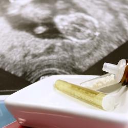 Homeopatie při porodu