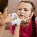 Krvácení z nosu u dětí. Máme spěchat k lékaři nebo zachovat klid?