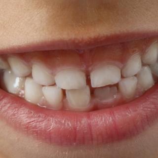 Zdravé a čisté zuby u dětí